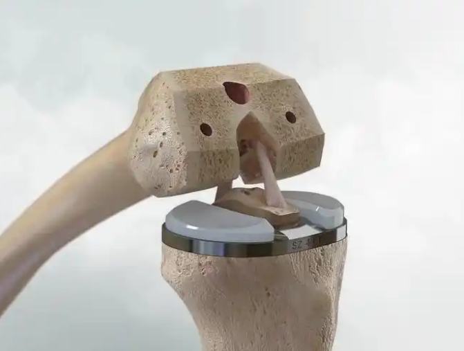 金相磨拋機生物醫(yī)學